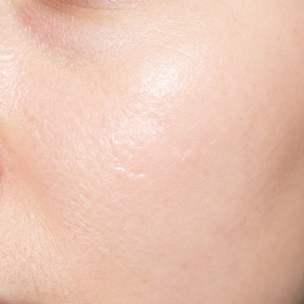 After Reafirmación de la Piel